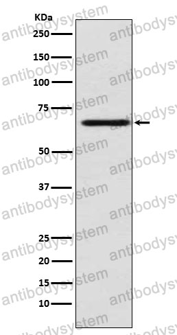 Anti-MADCAM1 Antibody (R2E41)
