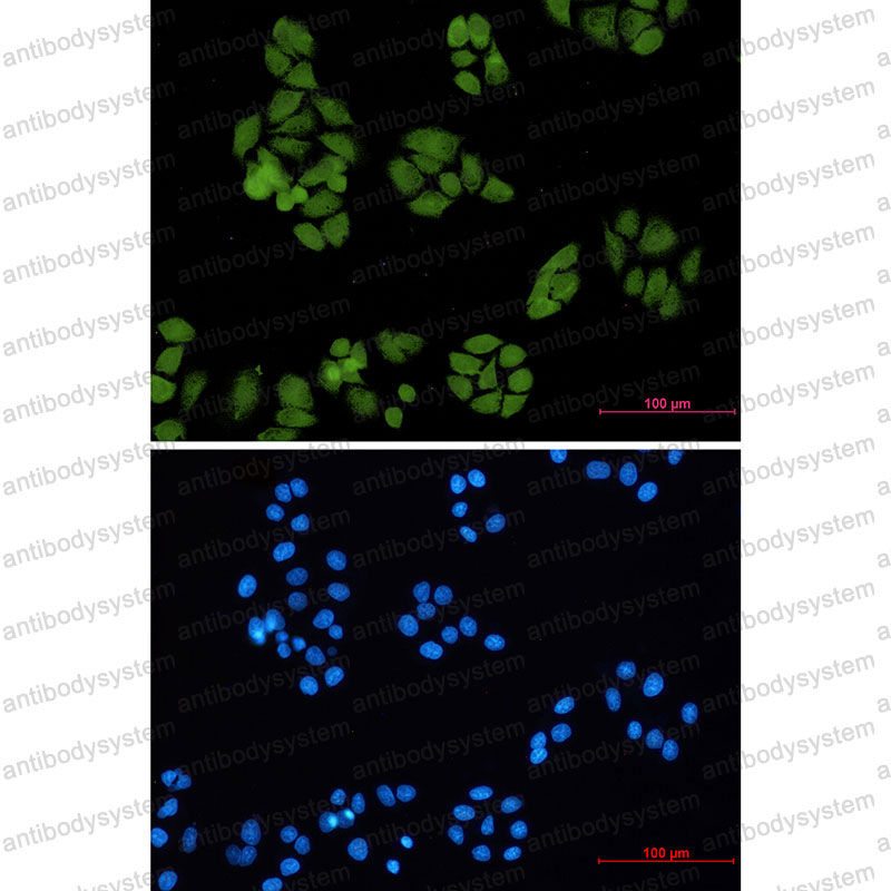 Anti-SMAD4 Antibody (R2E42)