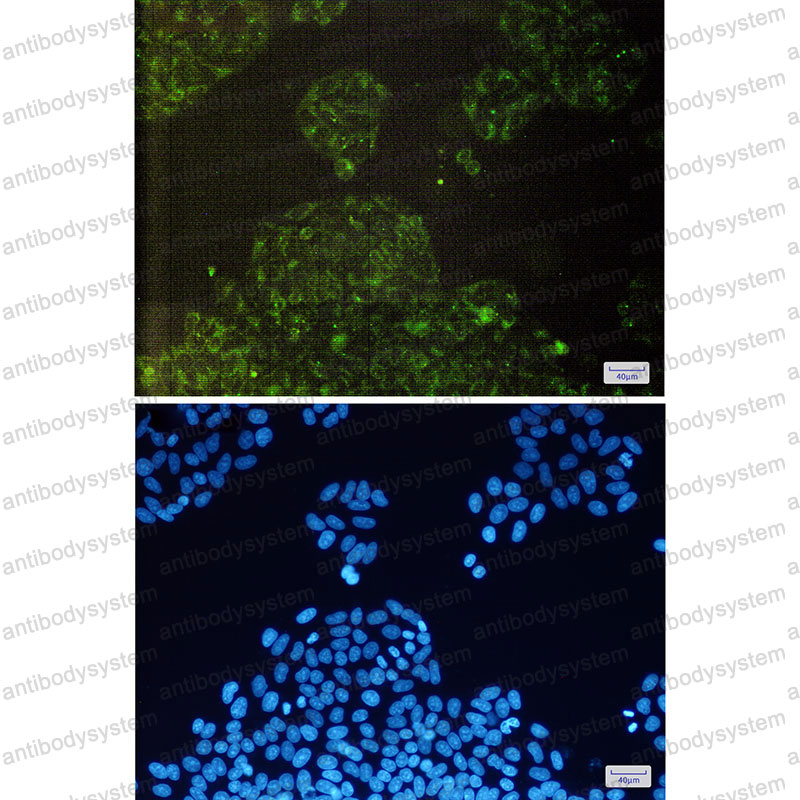 Anti-cIAP1/BIRC2 Antibody (R2E44)