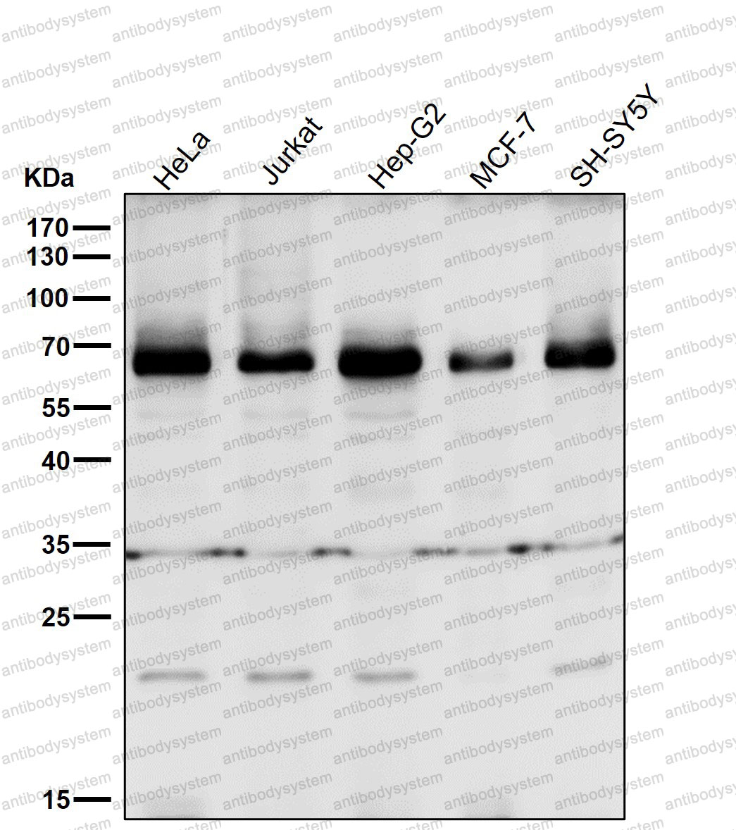 Anti-BIRC2 Antibody (R2E43)