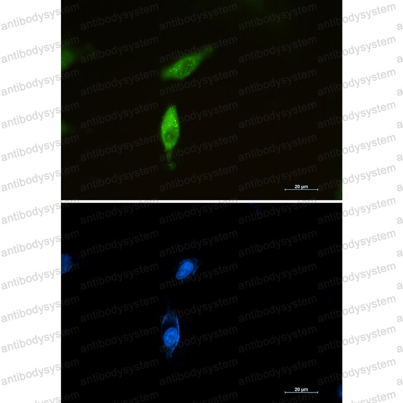 Anti-SQSTM1/p62 Antibody (R2E46)