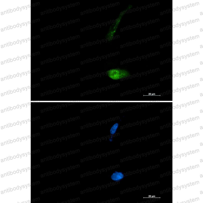Anti-SQSTM1/p62 Antibody (R2E47)