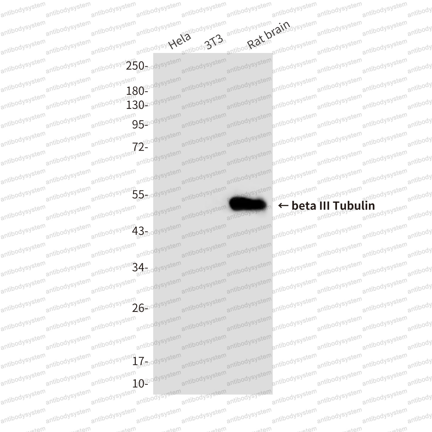 Anti-TUBB3/Beta Tubulin Antibody (R3S61)