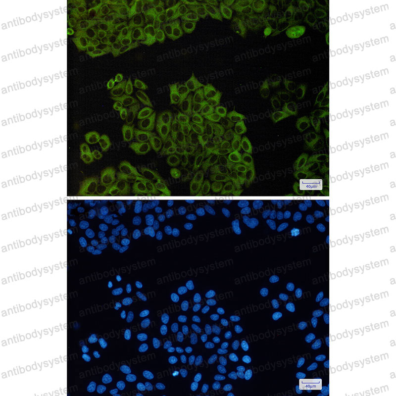 Anti-TUBB3/Beta Tubulin Antibody (R2E49)