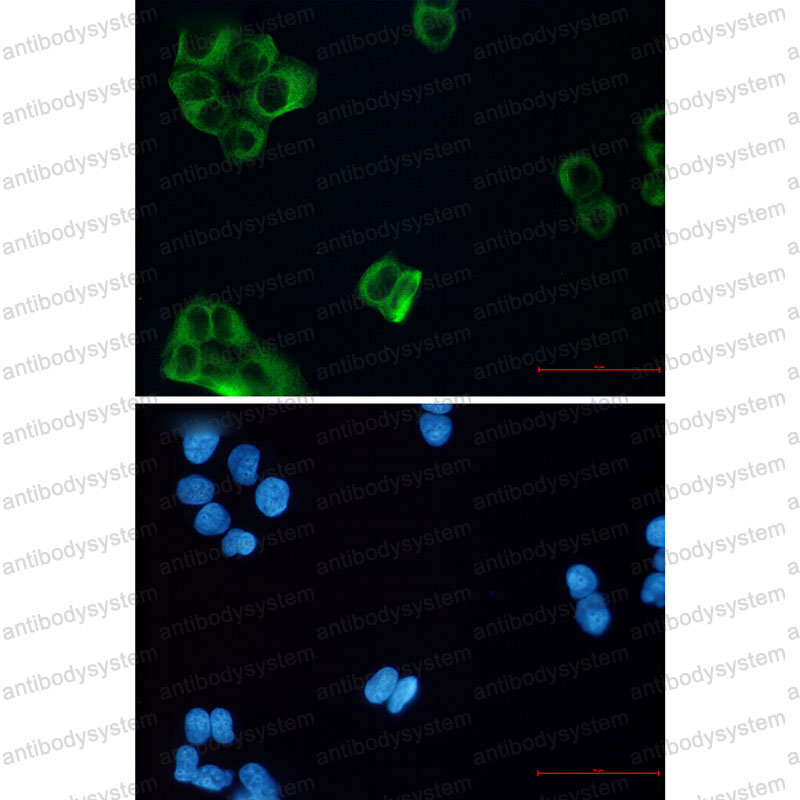 Anti-TUBB3/Beta Tubulin Antibody (R2E48)