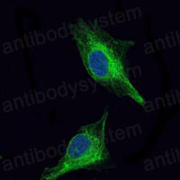Anti-OLIG2 Antibody (R3S62)