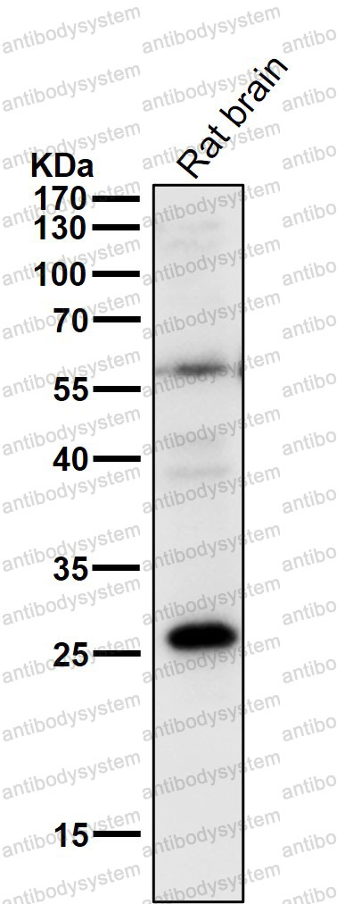 Anti-PPP1R1A Antibody (R2E50)