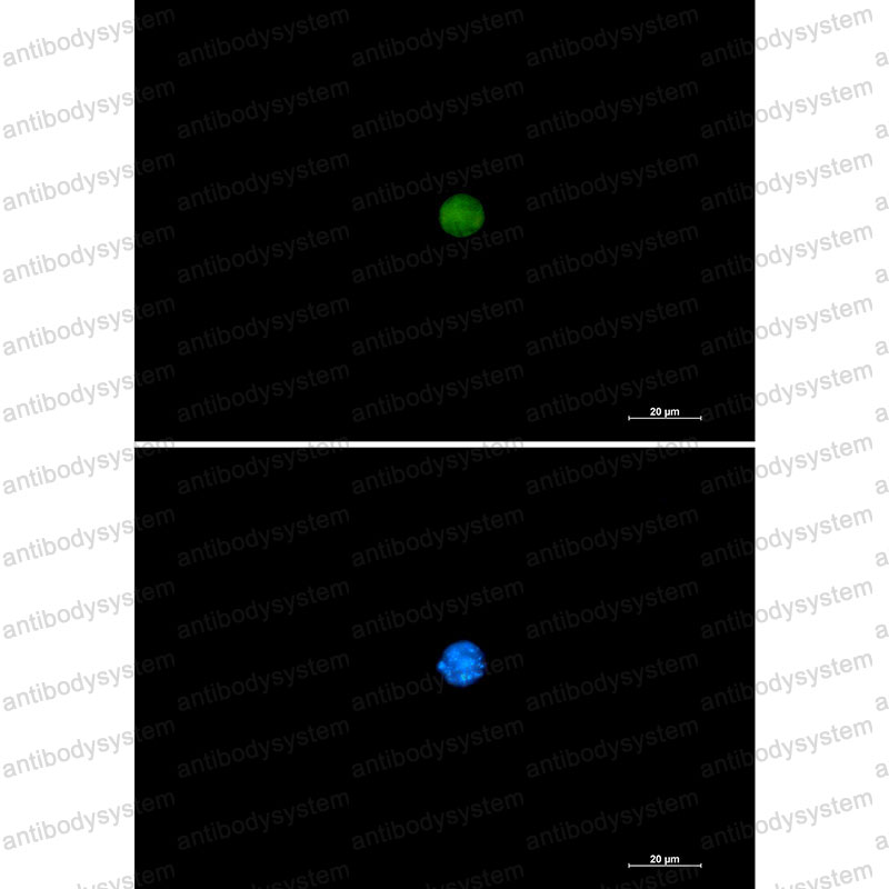 Anti-PIN1 Antibody (R2E51)
