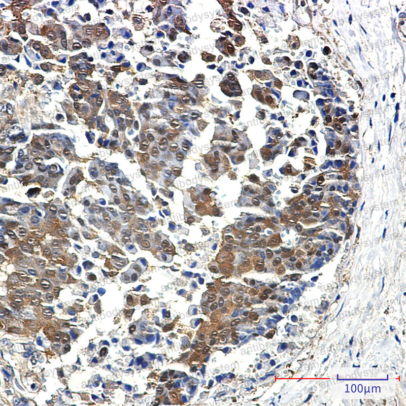 Anti-EIF4EBP1 Antibody (R2E54)