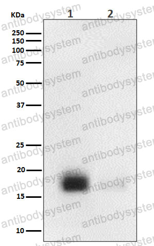 Anti-Phospho-EIF4EBP1/2/3 (T46 + T46 + T32) Antibody (R2E52)