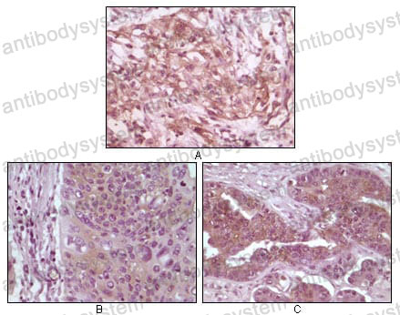 Anti-EIF4EBP1 Antibody (R3S64)