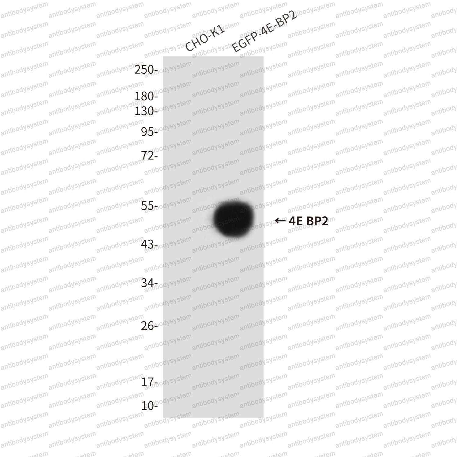 Anti-EIF4EBP2/4E-BP2 Antibody (R3S68)