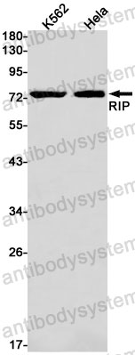 Anti-RIPK1 Antibody (R2E55)