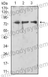 Anti-RIPK1 Antibody (R3S69)