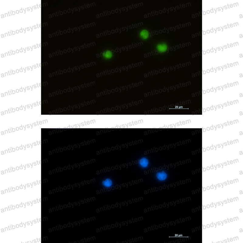 Anti-HDAC1 Antibody (R2E56)