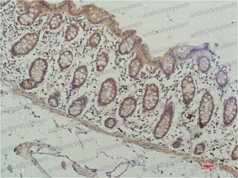 Anti-HDAC1 Antibody (R3S72)