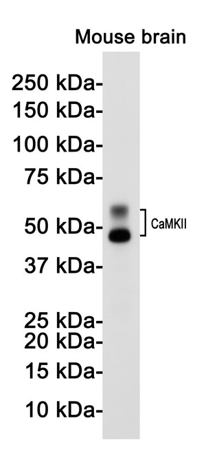 Anti-CAMK2B Antibody (R2E57)