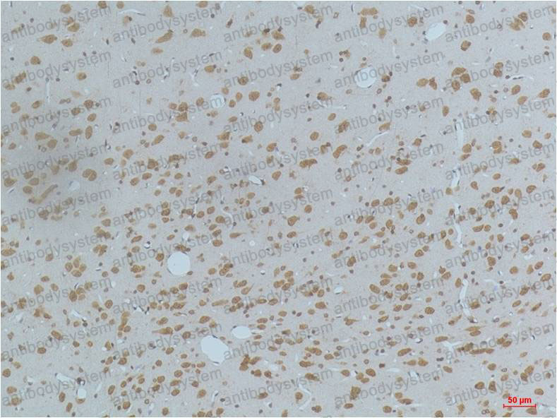 Anti-Phospho-CaMKII (Thr287) Antibody (R3S73)