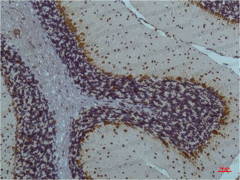 Anti-Phospho-CaMKII (Thr287) Antibody (R3S74)