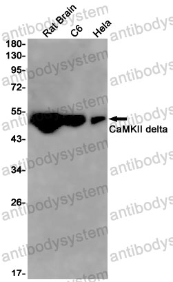 Anti-CAMK2D Antibody (R2E59)