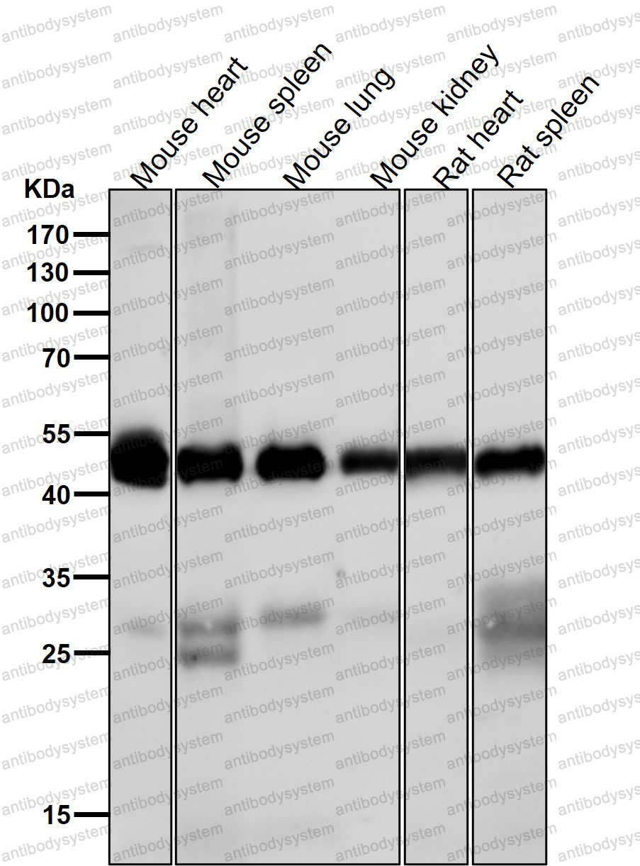 Anti-CAMK2D Antibody (R2E58)