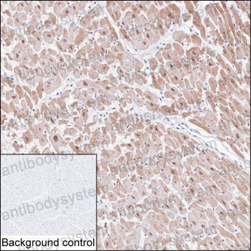 Anti-CAMK2D Antibody (R3S76)