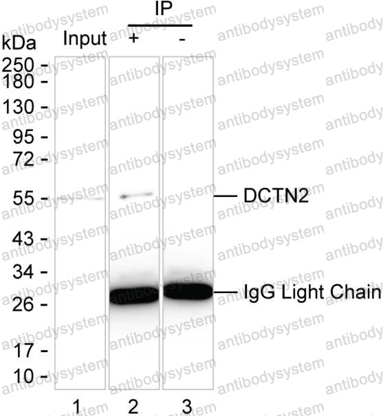 Anti-DCTN2 Antibody (R3S78)