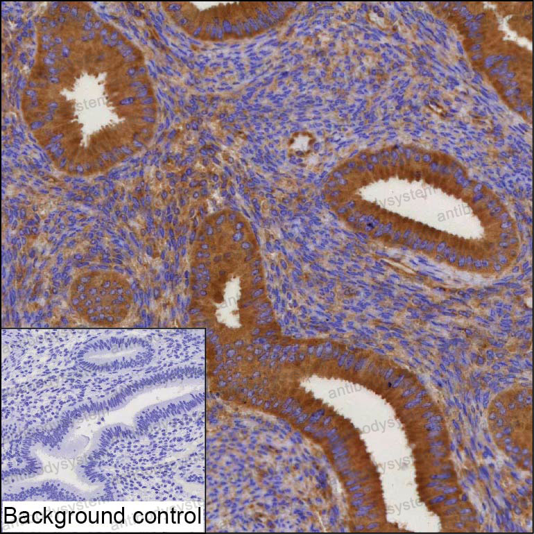Anti-DCTN2 Antibody (R3S77)