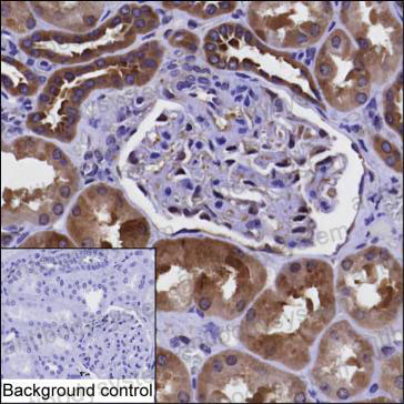 Anti-PKD2 Antibody (R3S80)