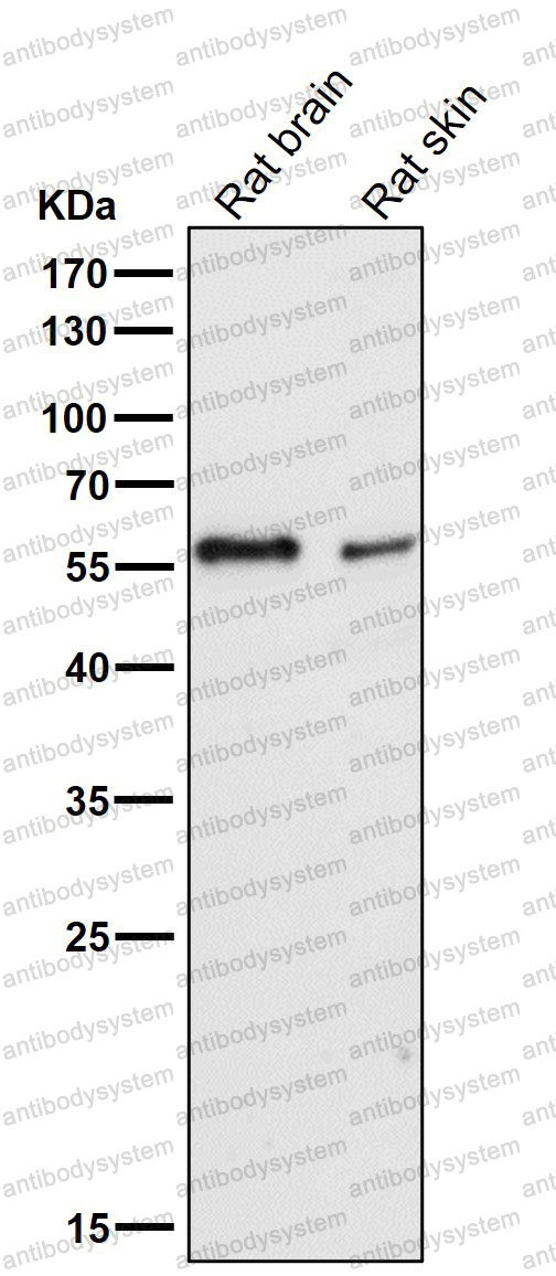 Anti-IRF5 Antibody (R2E62)