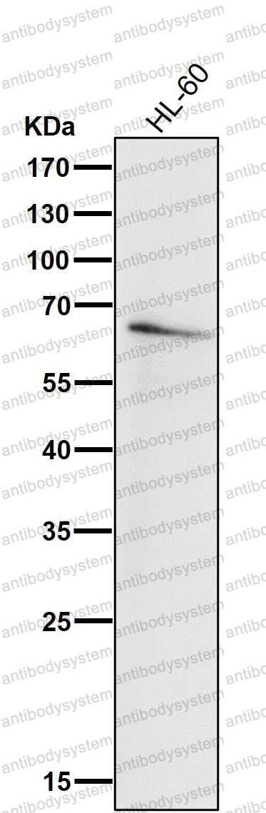 Anti-IRF5 Antibody (R2E61)