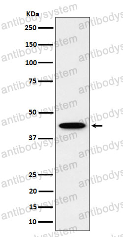 Anti-ITPK1 Antibody (R2E63)