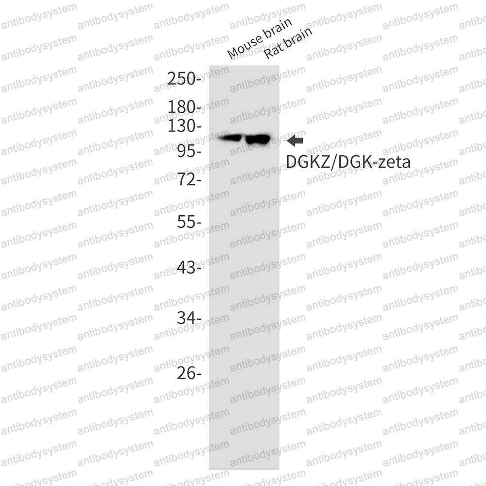 Anti-DGKZ Antibody (R2E66)