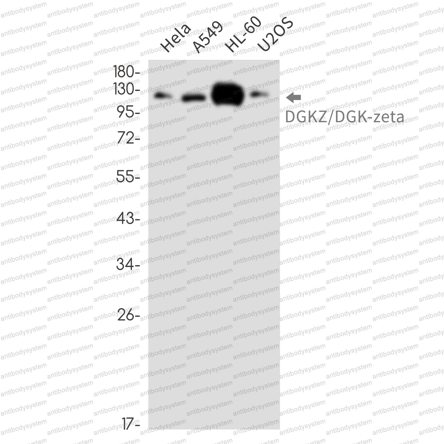 Anti-DGKZ Antibody (R2E65)