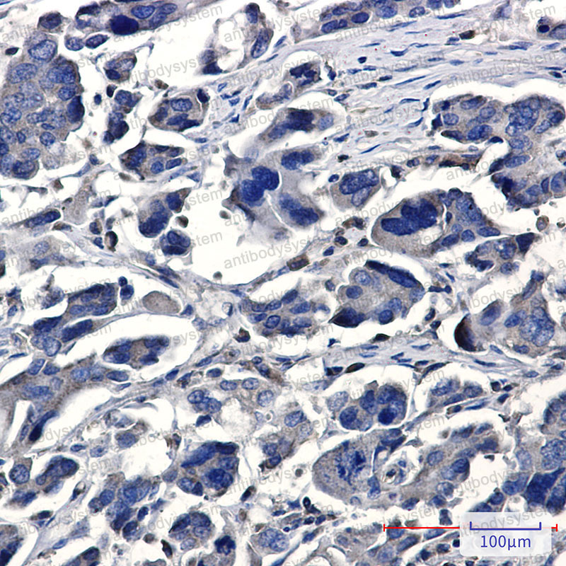 Anti-IQGAP2 Antibody (R2E69)