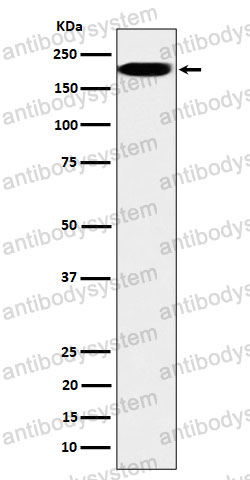Anti-IQGAP2 Antibody (R2E67)