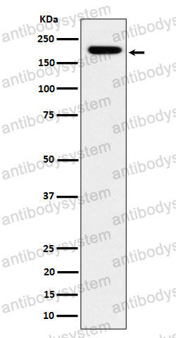 Anti-IQGAP2 Antibody (R2E68)