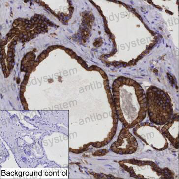 Anti-IQGAP2 Antibody (R3S83)