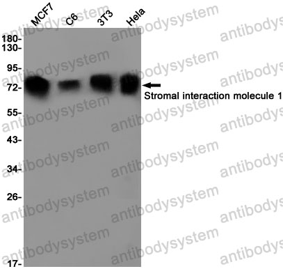 Anti-STIM1 Antibody (R2E71)
