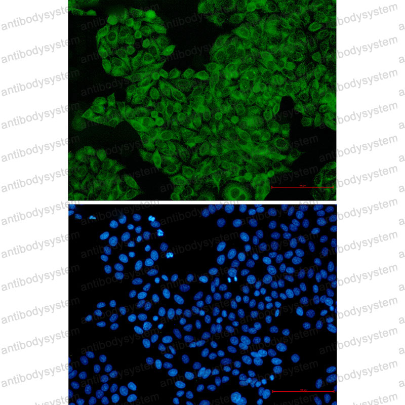 Anti-SNX1 Antibody (R2E73)