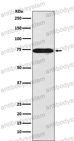 Anti-SNX1 Antibody (R2E72)