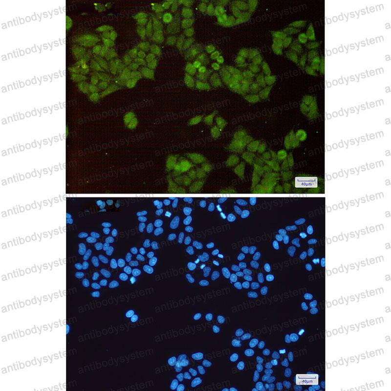 Anti-CUL1 Antibody (R2E77)