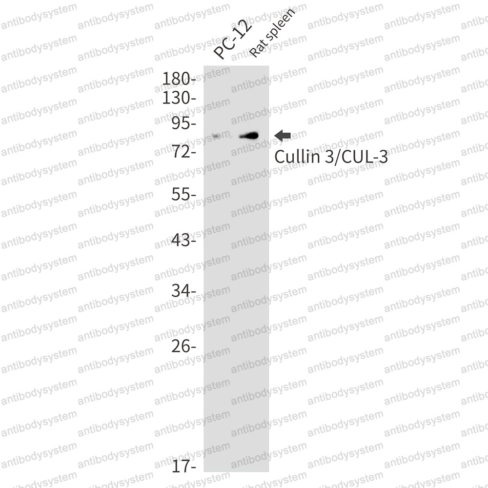 Anti-CUL3 Antibody (R2E81)
