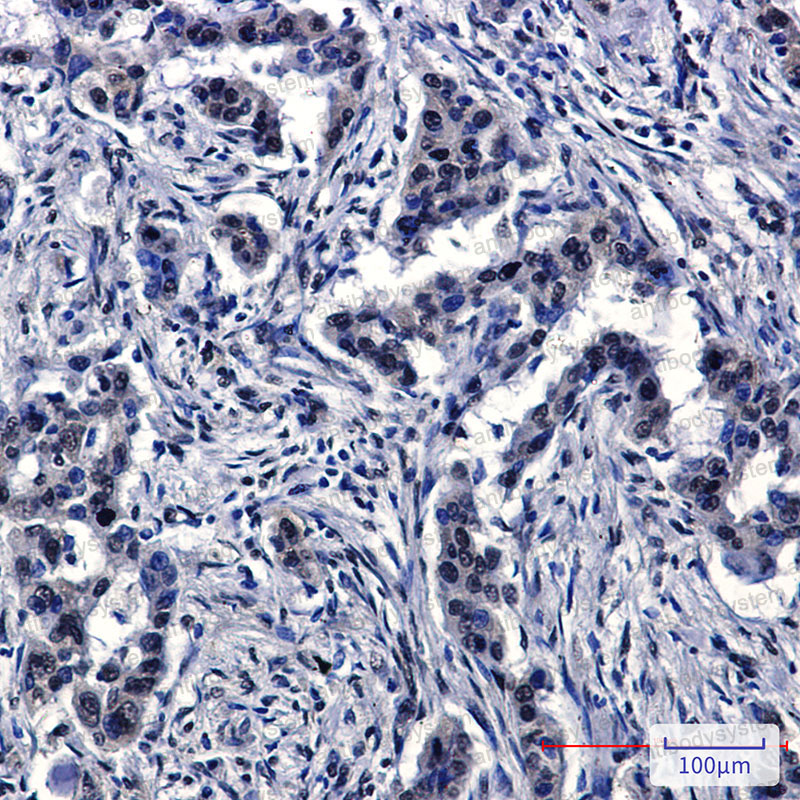 Anti-CUL4A Antibody (R2E83)