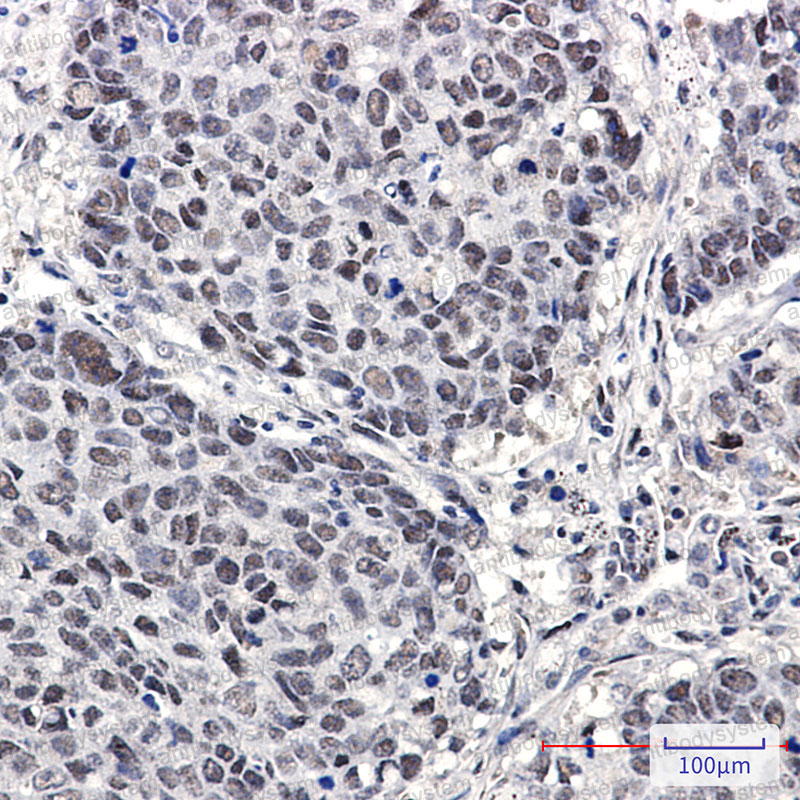 Anti-Cullin 4A/4B Antibody (R2E84)