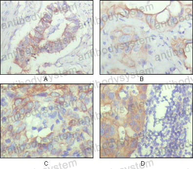 Anti-CD166/ALCAM Antibody (R3S87)