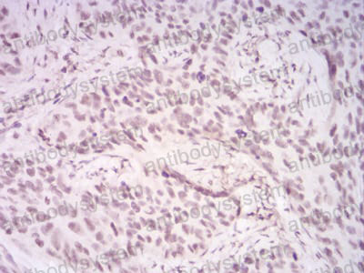 Anti-DDX39B/BAT1/UAP56 Antibody (R3S97)