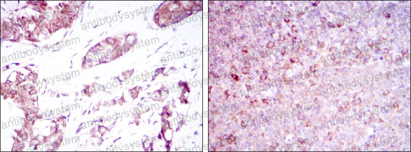 Anti-BMPR2 Antibody (R3S98)