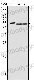 Anti-PTK6 Antibody (R3T01)