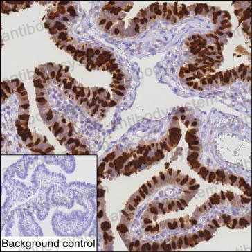 Anti-CAPS Antibody (R3T03)